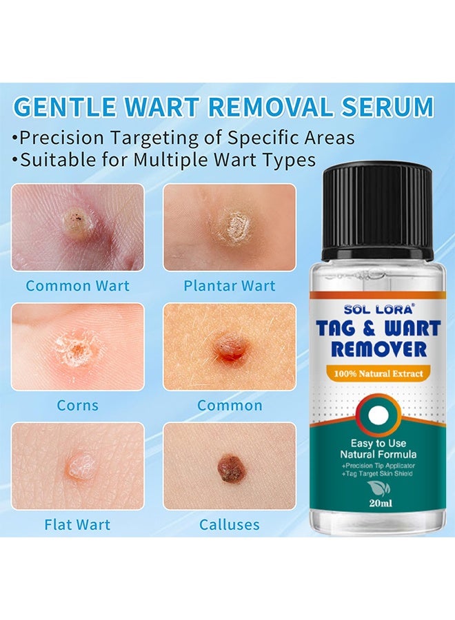SOL LORA Natural & Safe Wart And Mole Remover Liquid, Wart Remover Liquid, Salicylic Acid Fast-Acting Formula For Plantar Warts, Skin Tags, Corns & Callus Removal, Pain-Free Scar-Free Treatment, Toes & Foot Care For Men & Women, 20ml - Image 2